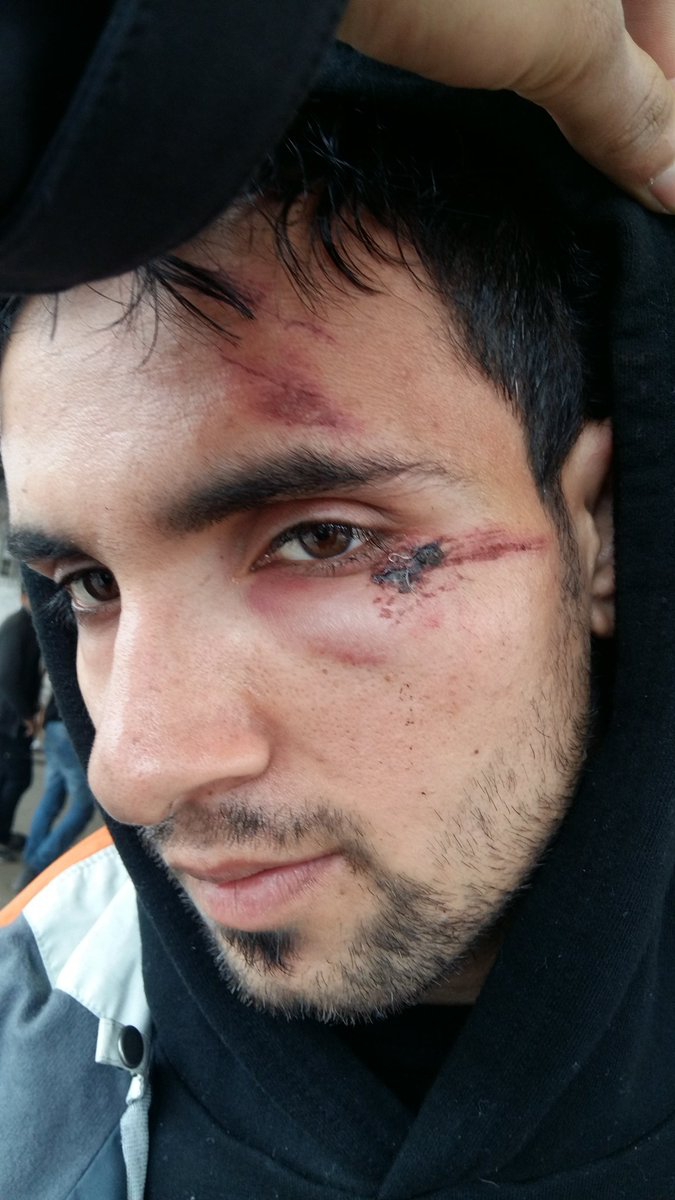An Afghan asylum-seeker provided images of what he said were injuries other migrants sustained from Hungarian authorities. An Afghan asylum-seeker provided images of what he said were injuries other migrants sustained from Hungarian authorities.